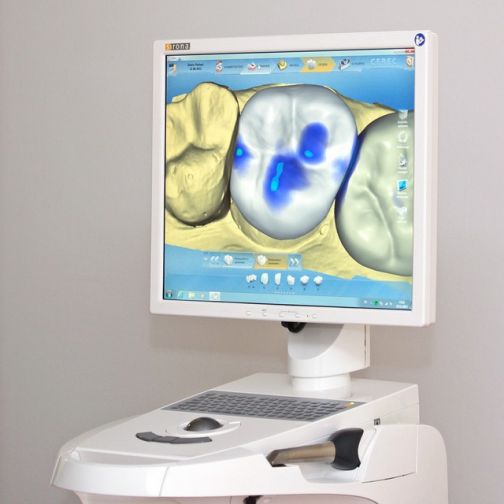 CEREC - Zahnärzte Kirchheim Dres. Markert & Müller